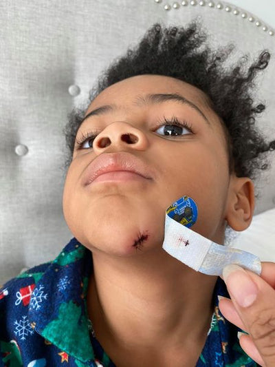 Fitz fell face first into his bed frame while chasing Gigi around the house?